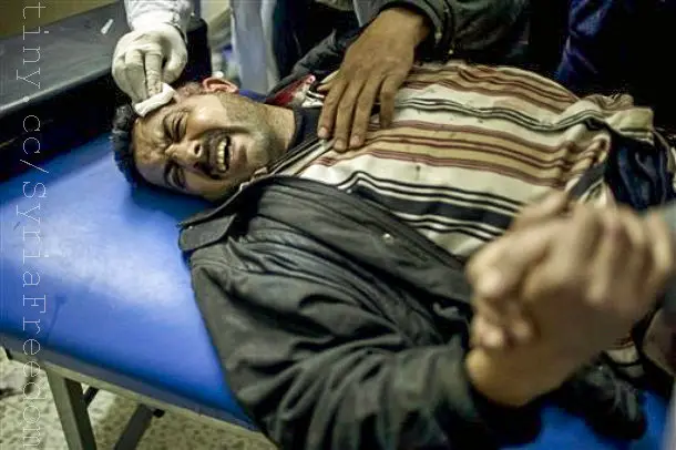 injured man in syria 