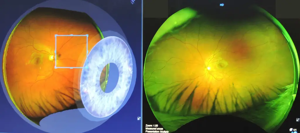 Virtual eye test scan