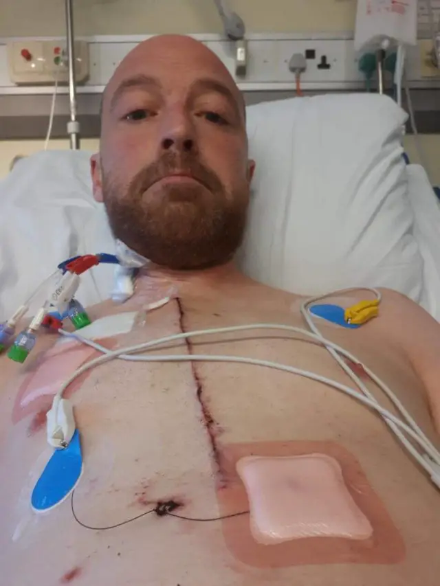 Nick Culshaw after heart-op 2018