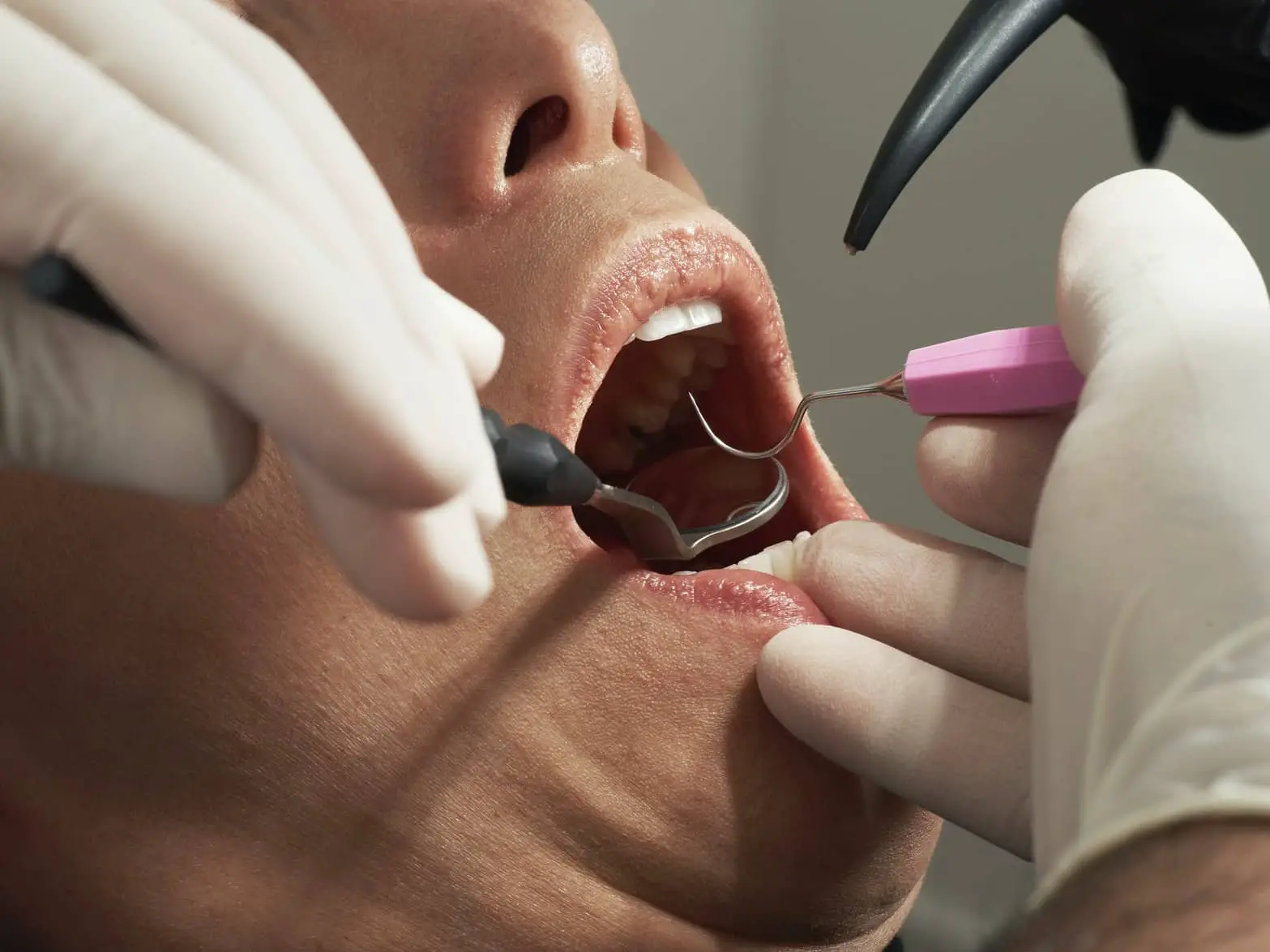 dentist working on a person