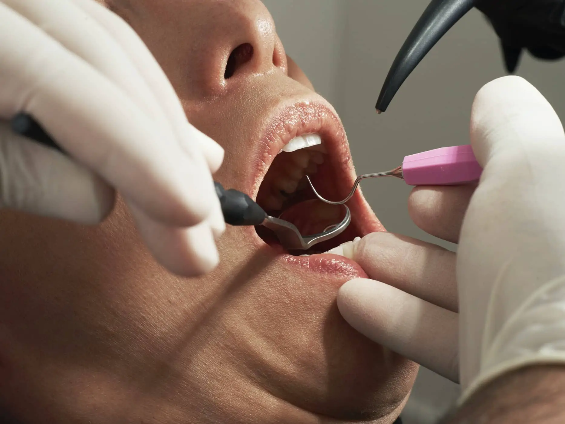 dentist looking into woman's mouth