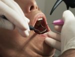 person having dental care