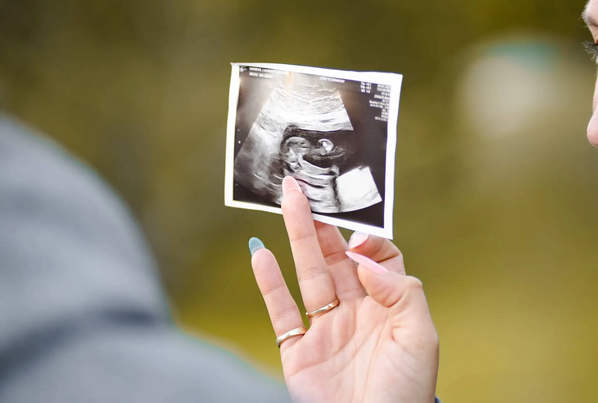 Woman holding scan of unborn baby