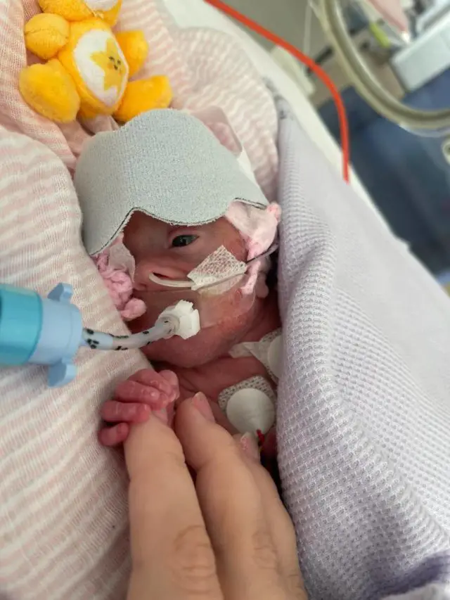 Baby Ava has a number of ongoing health challenges