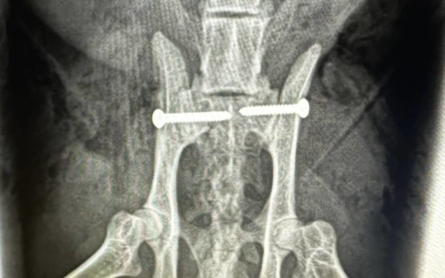 X-ray of spine with pins