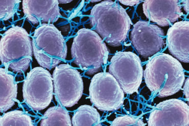 micrograph of gonorrhea bacteria