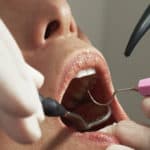 dentist looking into woman's mouth