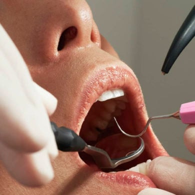 dentist looking into woman's mouth