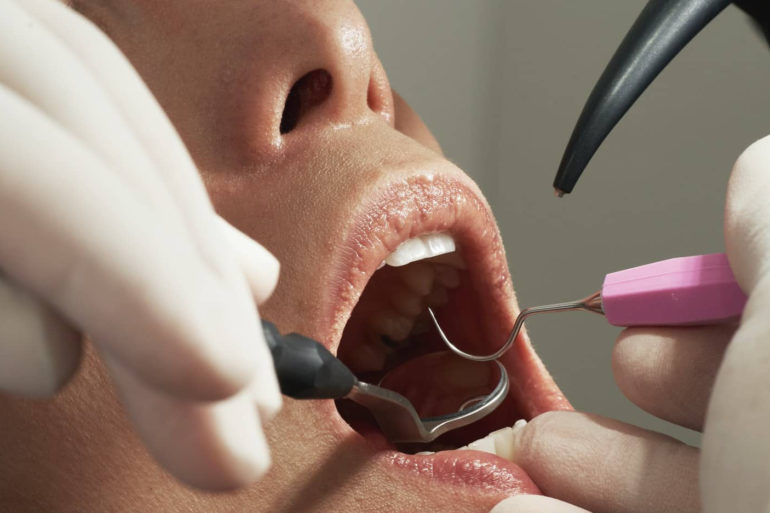 dentist looking into woman's mouth