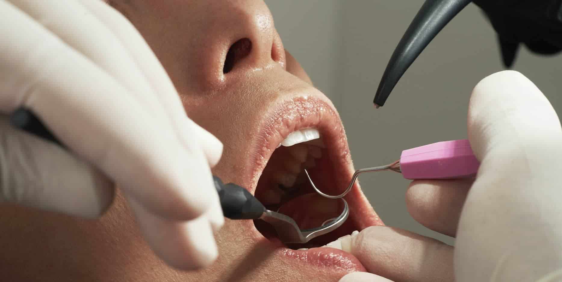 dentist looking into woman's mouth