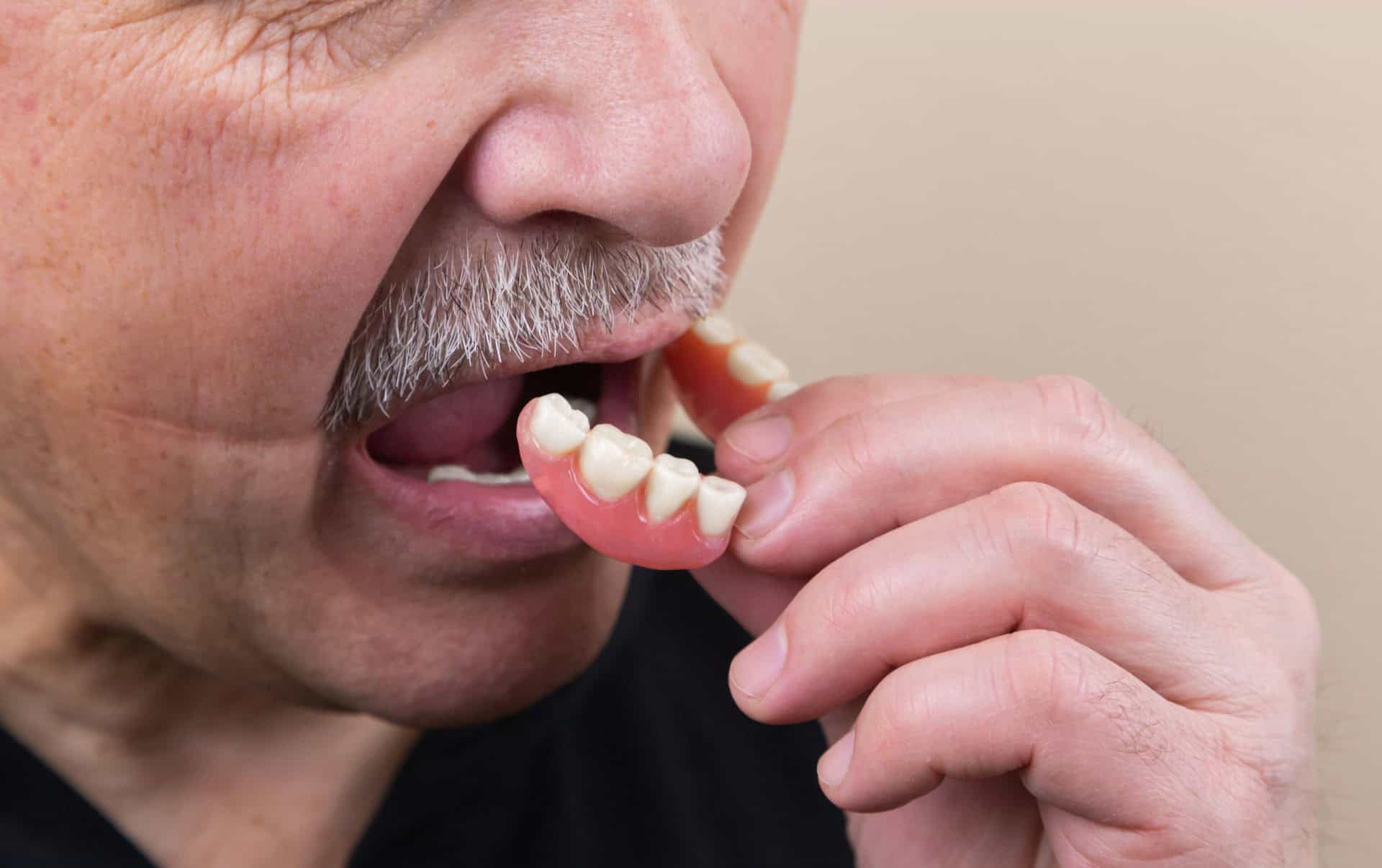 Man removing false teeth